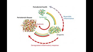 پاتوژنز یا نحوه ایجاد بیماری پریودنتال [upl. by Ennirok]