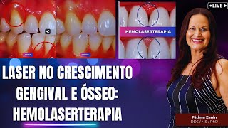 Laser no crescimento gengival Polpa e ósseo Fechamento de Black Spaces hemolaserterapia [upl. by Nosyt]