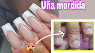 Uñas mordidas 😲 Onicofagia paso paso transformación aplicación con Tip 💅 [upl. by Lectra808]