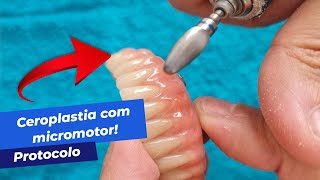 FAZENDO CEROPLASTIA EM UM PROTOCOLO DENTÁRIO Utilizando broca [upl. by Oilalue]