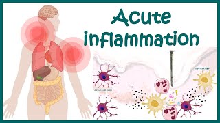 Acute Inflammation  symptoms Pathogenesis Cause of inflammation Mediators of Acute Inflammation [upl. by Yot]