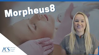 The Morpheus8 Treatment What is it Risks Results How to Prepare What to Expect Cost and More [upl. by Earized707]