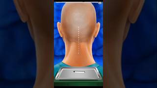 Back Head treatment shorts gaming viralvideo [upl. by Haisoj390]