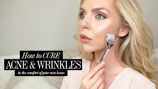 How to cure ACNE amp WRINKLES at home AD [upl. by Angus]