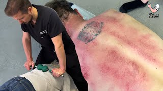 Chiropractor PUTS Full Weight 😳 Into Mans Back To Loosen Tight Joints  Gua Sha amp A CRUNCHY NECK [upl. by Htezzil989]