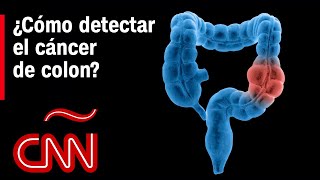 ¿Cómo detectar el cáncer de colon El Dr Huerta responde [upl. by Olegnaed393]