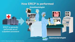 Understanding ERCP Endoscopic Retrograde Cholangiopancreatography [upl. by Novoj]