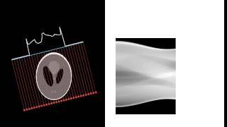 Collection of tomographic data from SheppLogan phantom [upl. by Bondy]