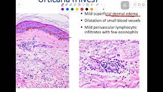 MSS pathology lab 1  part 1 [upl. by Endres]