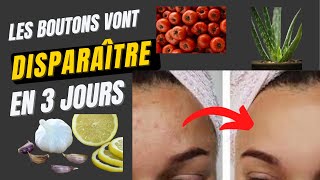 Comment éliminer les boutons du visage rapidement en 3 jours ≠4Astuces très efficaces [upl. by Naleek]