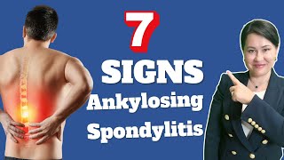 7 Signs of Ankylosing Spondylitis  A Rheumatologist Review [upl. by Linzy]