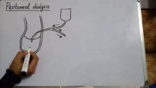 How to draw peritoneal dialysis diagram 10th Biology [upl. by Arol]