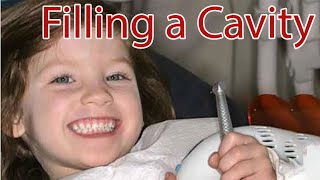 Child Dentistry  Filling the Cavity with a Composite [upl. by Cate168]