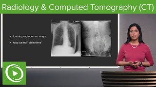 Radiology and Computed Tomography CT – Radiology  Lecturio [upl. by Oatis461]