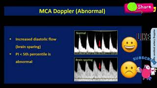 Obstetric Doppler Made Easy Part II [upl. by Ahsietal]