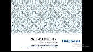 2 Diagnosis of Mycosis Fungoides [upl. by Enomyar]