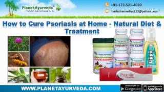 How to Cure Psoriasis at Home  Natural Diet amp Ayurvedic Treatment [upl. by Jorge]