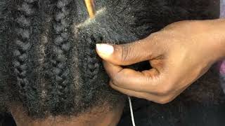 Asmr  Full cornrow takedown and satisfying scalp scratch 💤😴 asmrrelaxing [upl. by Jemmy]