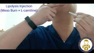 Lipolysis Injection using Meso Burn  Lcarnitine Vlog00042 [upl. by Heyes309]