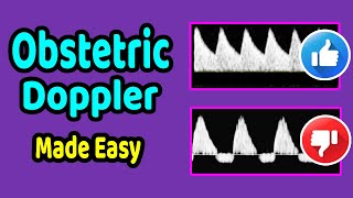 Obstetric Doppler Made Easy [upl. by Airrej406]