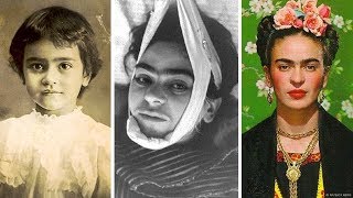 La trágica historia de Frida Kahlo [upl. by Kiel]