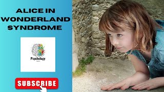 Alice in Wonderland Syndrome Visual Disturbance PsychologyToday 2023 [upl. by Reine]