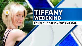 Get Out Change Your Life amp Dont Waste Time Tiffany Wedekind on Living With Progeria [upl. by Elac]