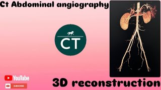 How did you make this  3D reconstruction abdominal Angiography  Ct Ge 32 revolution [upl. by Maurey]