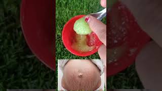 how to remove stretch mark at home best home remedies for stretch marks Priticreation [upl. by Marek]