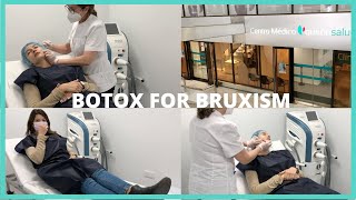 🩸💉BOTOX FOR BRUXISM BEFORE AND AFTER  AlexBeauty💉🩸 [upl. by Nacnud]