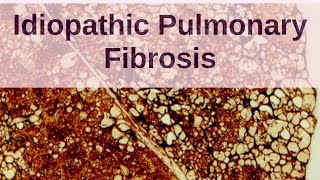 What is Idiopathic Pulmonary Fibrosis  Pathology mini tutorials [upl. by Nnylatsirk]