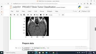 Brain Tumor Classification MRI  Brain Tumor Detection using Support Vector Machine in Python [upl. by Maurili]