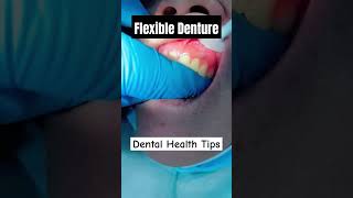 Flexible Denture DentalHealthTips [upl. by Repsaj48]