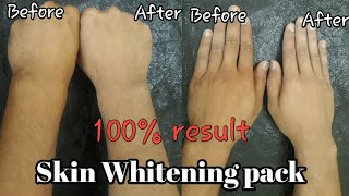 Kaolin Clay For Skin Whitening  Skin Whitening In 10 Minutes With Result  Kaolin Clay Facepack [upl. by Aymahs]