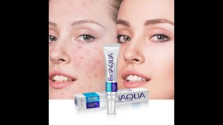 BIOAQUA Anti Acne Cream  Acne Scar Removal Cream  bioaqua acnetreatment acnescars pimple [upl. by Oirevlis]