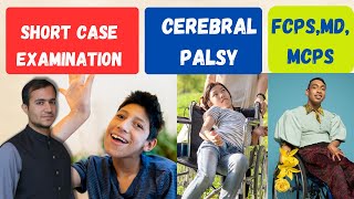 Cerebral palsy  Short and long case examination  Practical approach for medical students [upl. by Esyak]