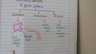 Malignant Mesothelioma Pathology  Morphology [upl. by Amersham]