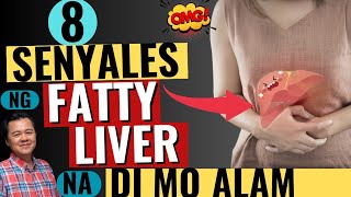 8 Senyales ng Fatty Liver na Di Mo Alam  by Doc Willie Ong [upl. by Lorry]