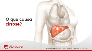 O que causa cirrose  Clínica Hepatogastro [upl. by Placeeda]