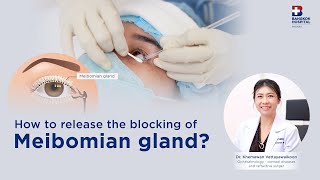 How to release the blocking of Meibomian gland [upl. by Atiugal228]