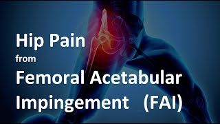 Hip Pain from Femoral Acetabular Impingement FAI  What is it and how to treat it [upl. by Mikael104]