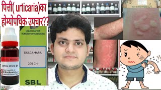 Urticaria Homeopathic medicine for Urticaria explain [upl. by Buiron262]