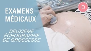 La 2e échographie de grossesse  Examens grossesse [upl. by Corry120]