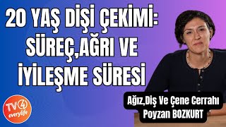 20 Yaş Dişi Çekimi Süreç Ağrı ve İyileşme Süresi [upl. by Merceer]