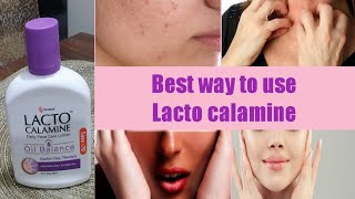 Lecto Calamine Lotion UsesBest 5 Way to Use On SkinNo More Dry pigmentedItcy Skin [upl. by Peacock]