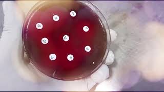 Optochin Streptococcus pneumoniae  Viridans spreptococci [upl. by Ahsirahc]