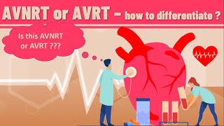 AVNRT VS AVRT  How to differentiate AVNRT from AVRT on ECG  definition ECG findings and examples [upl. by Sivolc]