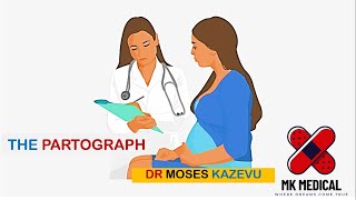 Partograph  How to plot a partograph [upl. by Yanrahc]