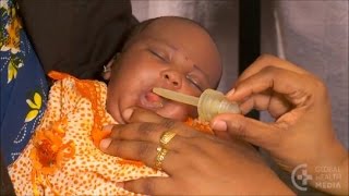 Preparing and Giving Oral Amoxicillin  Newborn Care Series [upl. by Hurst158]