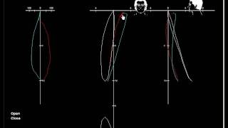 Right Side Chewing Flat Occlusionwmv [upl. by Koch]